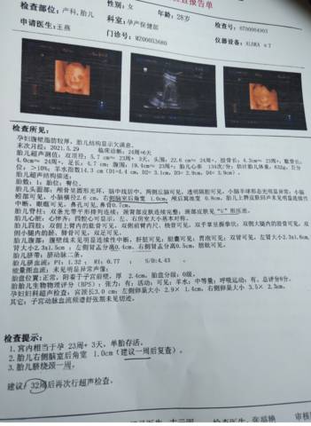 journal_insert_pic_1664826747