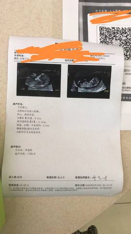 journal_insert_pic_1838592878