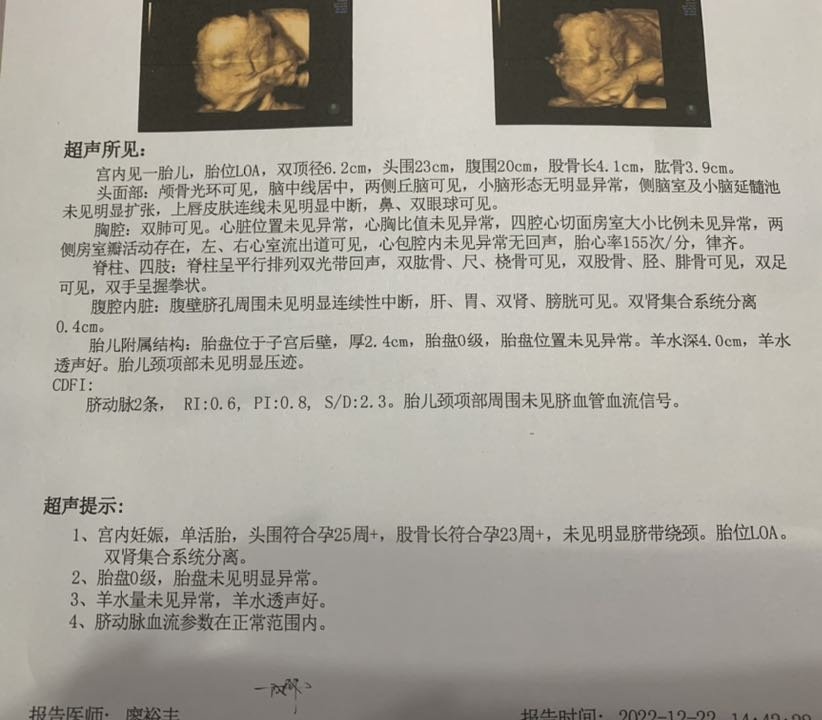 有会看性别的吗？