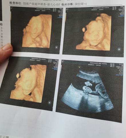 journal_insert_pic_4103601792