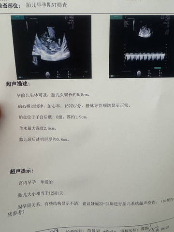 journal_insert_pic_4114726125