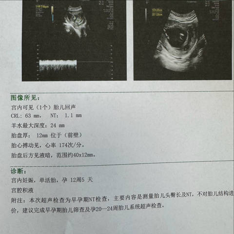 journal_insert_pic_4115857713