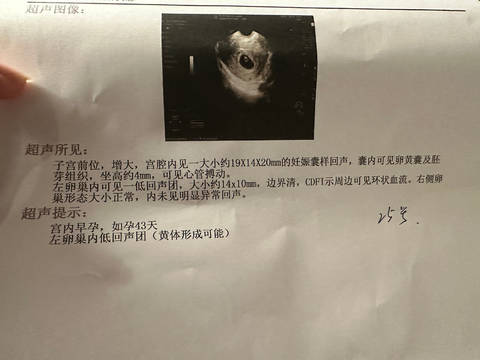 journal_insert_pic_4116829482