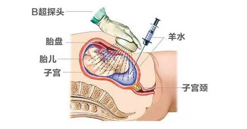 journal_insert_pic_1003458162