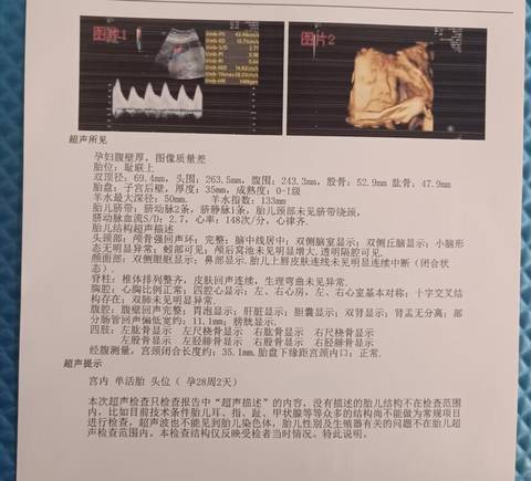 有没有知道是男是女的给看看